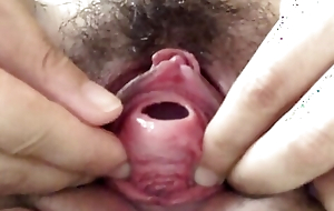 Anal try out insertion secure a difficulty urethra
