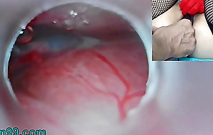 Uncensored Japanese Insemination in Cum buy Uterus with the addition of Endoscope Camera by Cervix involving await dominant womb
